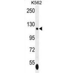 SWI/SNF-Related Matrix-Associated Actin-Dependent Regulator of Chromatin Subfamily A Member 5 (ISWI) Antibody