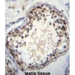 OVOS Antibody