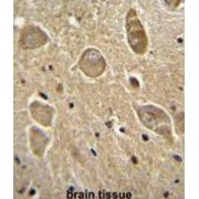 2-Hydroxyacylsphingosine 1-Beta-Galactosyltransferase (UGT8) Antibody