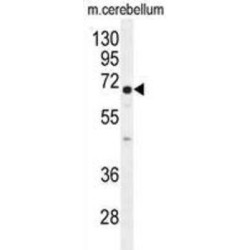 2-Hydroxyacylsphingosine 1-Beta-Galactosyltransferase (UGT8) Antibody