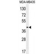 Leukocyte Immunoglobulin Like Receptor A5 (LILRA5) Antibody