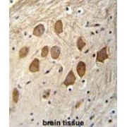 Host Cell Factor C1 Regulator 1 (HCFC1R1) Antibody