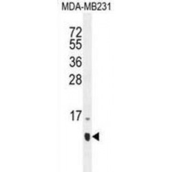 Host Cell Factor C1 Regulator 1 (HCFC1R1) Antibody