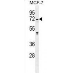 N-Acetylgalactosamine 6-Sulfatase (GALNS) Antibody