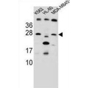 Dickkopf-Related Protein 4 (DKK4) Antibody
