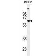 Solute Carrier Family 16, Member 8 (SLC16A8) Antibody
