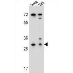 Ephrin B2 (EFNB2) Antibody