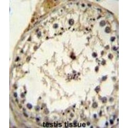 Growth Differentiation Factor 6 (GDF6) Antibody