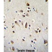Homeobox Protein OTX2 (OTX2) Antibody