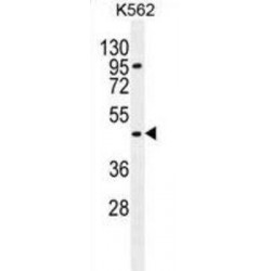Mast Cell Carboxypeptidase A (CPA3) Antibody