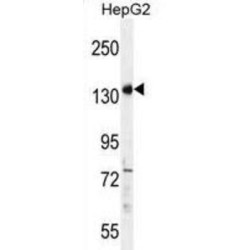 Partner And Localizer of BRCA2 (PALB2) Antibody