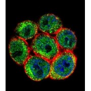 Slingshot Homolog 3 (SSH3) Antibody