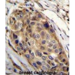 Slingshot Homolog 3 (SSH3) Antibody