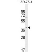 Transcription Factor JunB (JUNB) Antibody