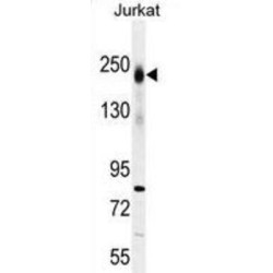 Receptor-Type Tyrosine-Protein Phosphatase C / CD45 (PTPRC) Antibody