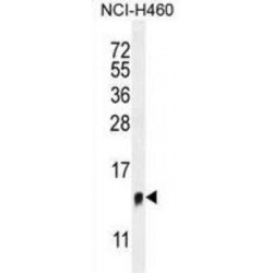 Transmembrane Protein 100 (TMEM100) Antibody