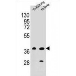 Bruno-Like Protein 6 (BRUNOL6) Antibody