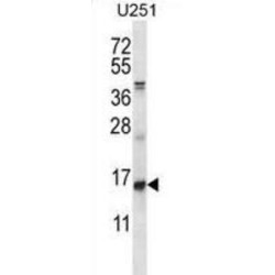 DNA-Binding Protein Inhibitor ID-1 (ID1) Antibody