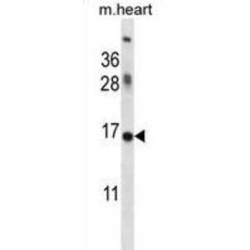 DNA-Binding Protein Inhibitor ID-1 (ID1) Antibody
