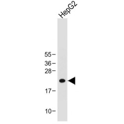 DNA-Binding Protein Inhibitor ID-1 (ID1) Antibody