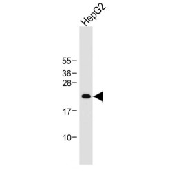 DNA-Binding Protein Inhibitor ID-1 (ID1) Antibody