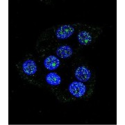 Coiled-Coil Domain Containing 36 (CCDC36) Antibody