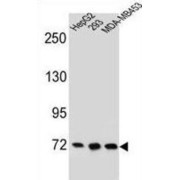 Zinc Finger Protein 860 (ZNF860) Antibody