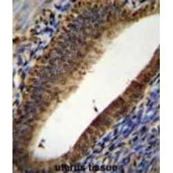 Prothymosin Alpha (PTMA) Antibody