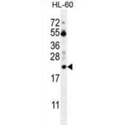 Prothymosin Alpha (PTMA) Antibody