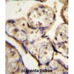 Tubulin Beta-1 Chain (TBB1) Antibody