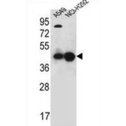 Purine Rich Element Binding Protein A (PURA) Antibody