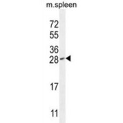 Isoamyl Acetate-Hydrolyzing Esterase 1 Homolog (IAH1) Antibody
