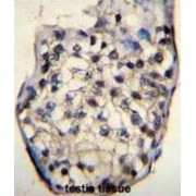 Outer Dense Fiber Of Sperm Tails 3 (ODF3) Antibody