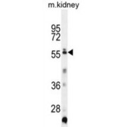 Probable E3 Ubiquitin-Protein Ligase TRIML1 (TRIML1) Antibody