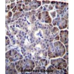 Myosin-Binding Protein H-Like (MYBPHL) Antibody