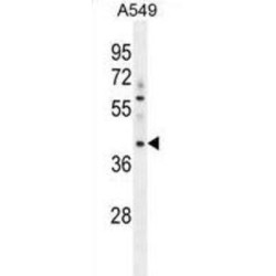 Myosin-Binding Protein H-Like (MYBPHL) Antibody