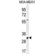 TNF Alpha Induced Protein 8 Like 3 (TNFAIP8L3) Antibody
