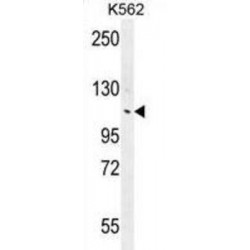 Ankyrin Repeat Domain-Containing Protein 18B (ANKRD18B) Antibody