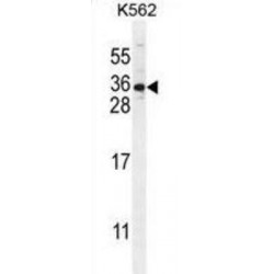 StAR-Related Lipid Transfer Protein 6 (STARD6) Antibody