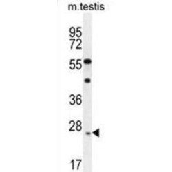 Ropporin-1-Like Protein (ROPN1L) Antibody