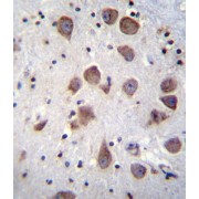 Calcium/calmodulin-Dependent 3',5'-Cyclic Nucleotide Phosphodiesterase 1B (PDE1B) Antibody