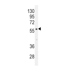 Calcium/calmodulin-Dependent 3',5'-Cyclic Nucleotide Phosphodiesterase 1B (PDE1B) Antibody