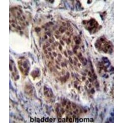 Frequently Rearranged In Advanced T-Cell Lymphomas 2 (FRAT2) Antibody