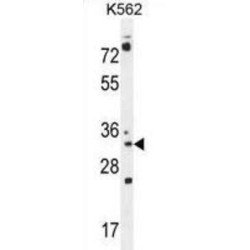 Pyrroline-5-Carboxylate Reductase Family Member 2 (PYCR2) Antibody