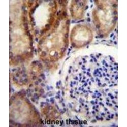 Chloride Voltage-Gated Channel 7 (CLCN7) Antibody