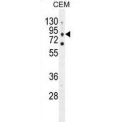 Chloride Voltage-Gated Channel 7 (CLCN7) Antibody