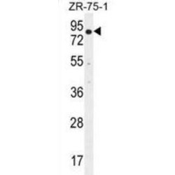 F-Box/WD Repeat-Containing Protein 1A (BTRC) Antibody