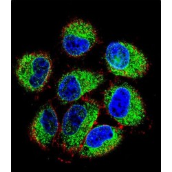 TBC1 Domain Family Member 13 (TBC1D13) Antibody