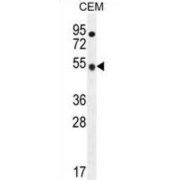 WB analysis of CEM cell line lysates.