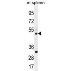 TBC1 Domain Family Member 13 (TBC1D13) Antibody